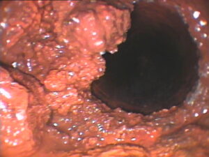 管内写真（赤さび）